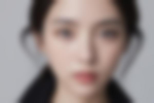 郑州洛生整形医生技术好吗？鼻眼整形+脂肪填充选他靠谱吗？