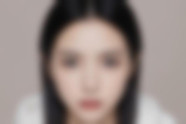 1、汇美幼态脸打造显著