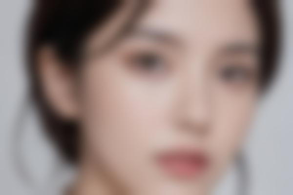 石家庄陈慧玲医生胎记疤痕修复技术强，无疤不痛修复自然！