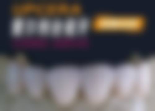 仅需 1 元！上海美奥口腔门诊部贴面方案设计，快速改善牙齿美观 