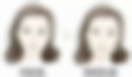 异物取出项目详情