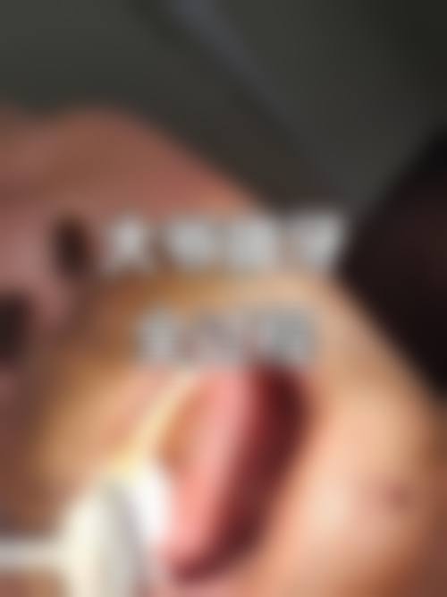 湖北荆州松滋齐贝口腔价格收费