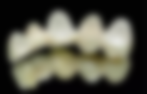 韩国Glory整形外科价格收费