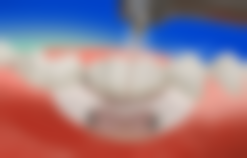 重庆众植博仕口腔门诊部(涪陵区)患者口碑