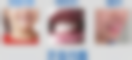 重庆众植博仕口腔门诊部(涪陵区)价格收费