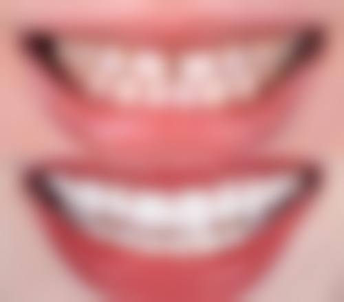 海涛口腔门诊部价格收费