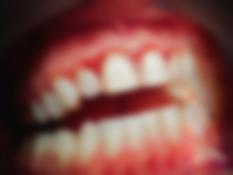 韩国Glory整形外科患者口碑