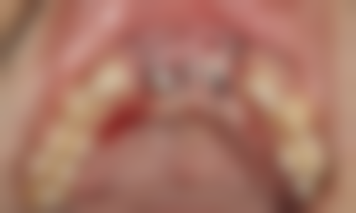 酒泉生达口腔医院(新城分院)价格收费