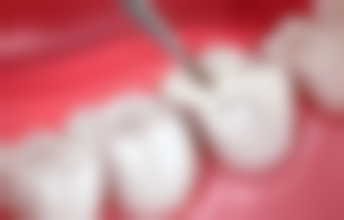 太原何炳玲口腔来院路线