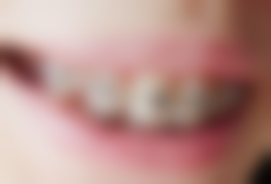 江苏苏州太仓华东口腔的来院路线