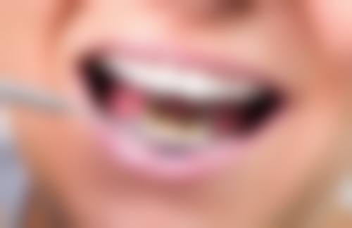 舒桃的临床实战与真实实例