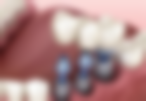 夏熹的临床实战与真实实例