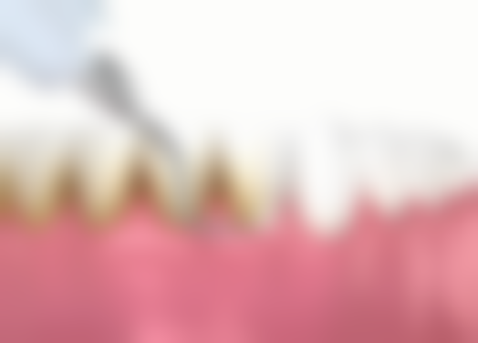 深圳诺德长湖口腔的技术优势