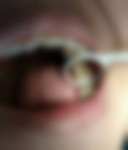 夏津王双双口腔价格收费