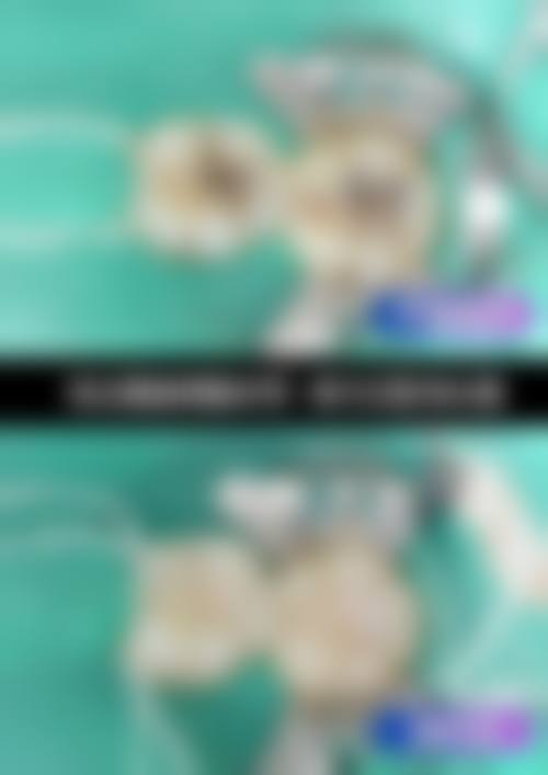 夏津王双双口腔患者口碑