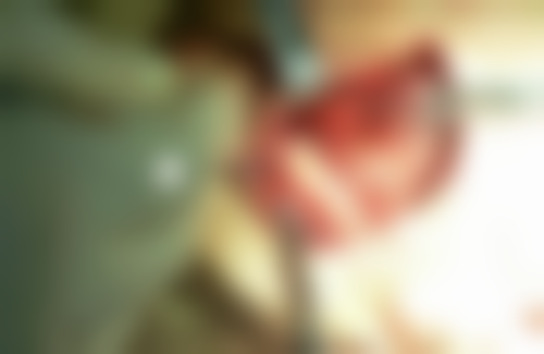 廖蓉的临床实战与真实实例