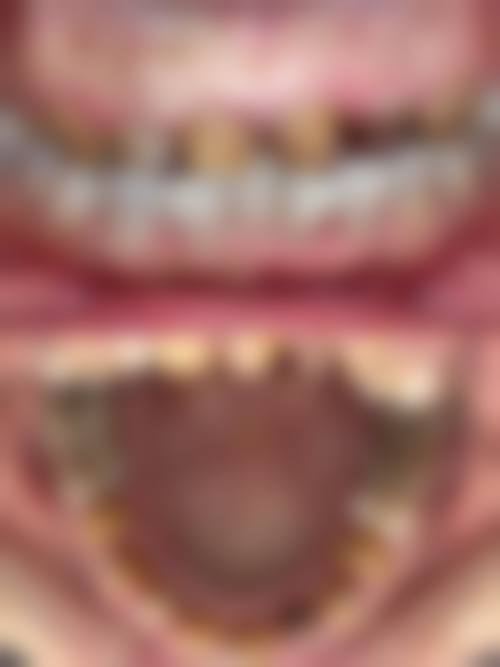 廖蓉的临床实战与真实实例