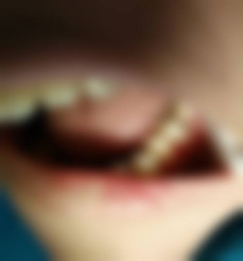 呼伦贝尔元洪口腔诊所的价格收费