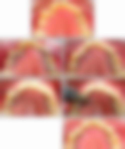 武威市中医医院西院区口腔科的价格收费