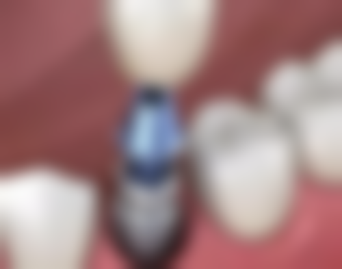 柏德口腔医院价格收费