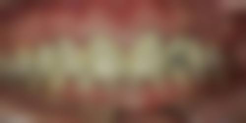 代国强的临床实战与真实实例