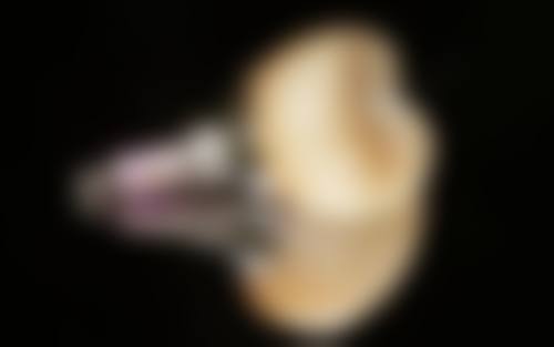 曹益辉的临床实战与真实实例