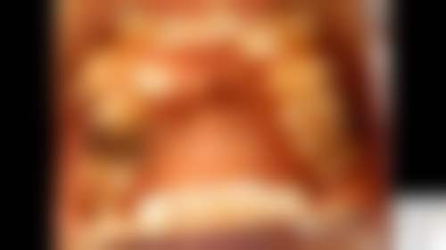 深圳维港口腔门诊部(福田口岸院)的来院路线