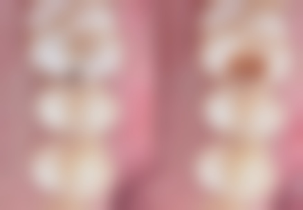 武延孙的临床实战与真实实例