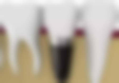 韩亚春的临床实战与真实实例