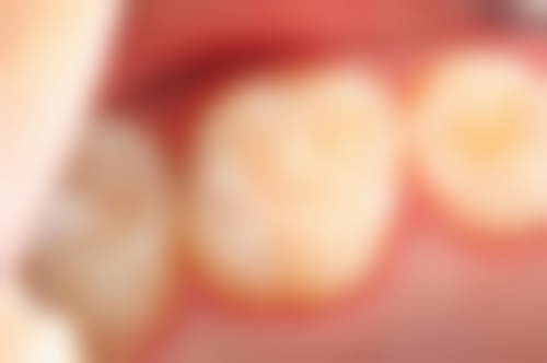 台州项氏口腔价格收费