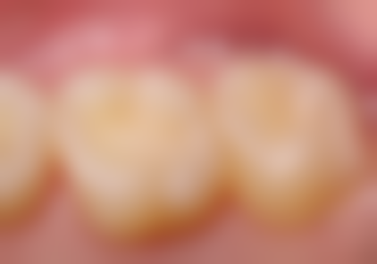 韩亚春的价格与坐诊