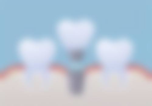 齐齐哈尔正阳牙科的价格收费