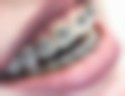 齐齐哈尔正阳牙科的技术优势