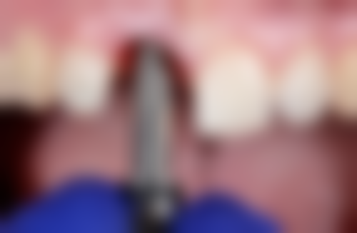 王婷的诊疗标准与服务细节