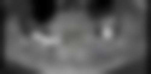 成都武侯红牌楼海涛口腔门诊部患者口碑