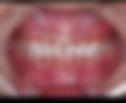 东莞长安金信口腔的来院路线