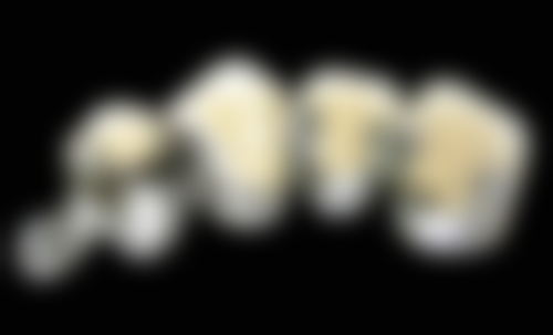 景德镇乐平冯治坪口腔门诊部的价格收费