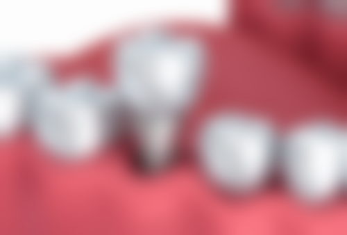 济南槐荫嘉悠口腔的来院路线