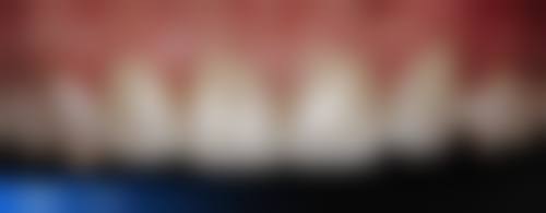 田家庵张诚口腔诊所的患者口碑