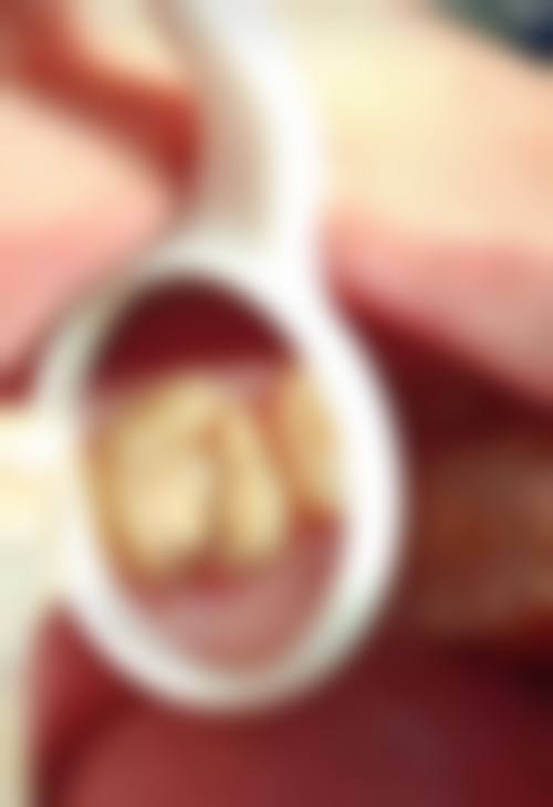 山东威海邹铭口腔诊所价格收费