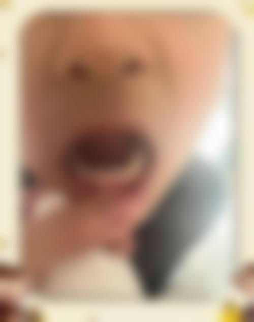 杭州桐庐艾伢口腔的患者口碑