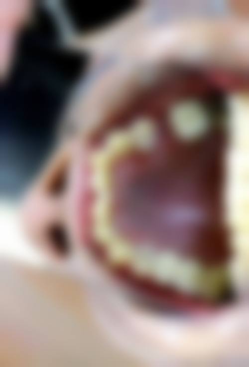 深圳刚翰口腔门诊部的来院路线