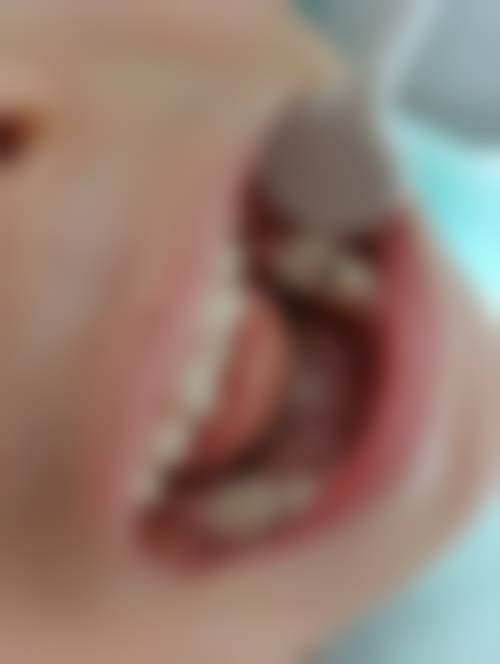 杭州桐庐艾伢口腔的来院路线