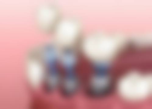 黄佳琪的临床实战与真实实例