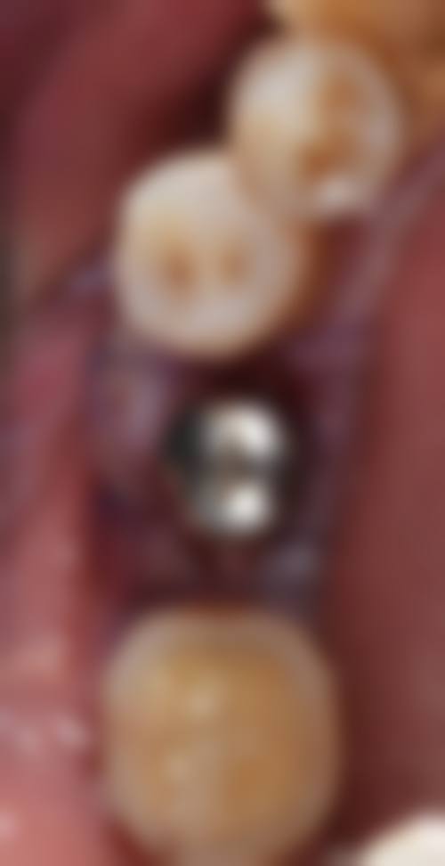 沙湾刘秀光口腔诊所的患者口碑