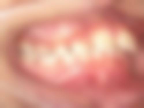 深圳科兴好佰年口腔门诊部（深圳总院）价格收费