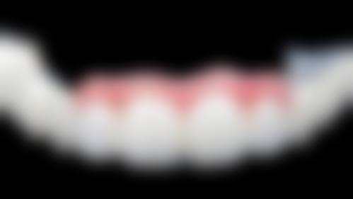 东莞钟载强口腔价格收费