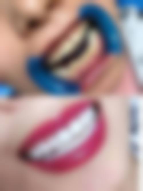 方孝猛的临床实战与真实实例