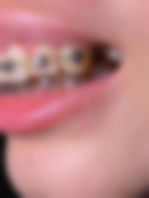 深圳众雅口腔诊所的技术优势