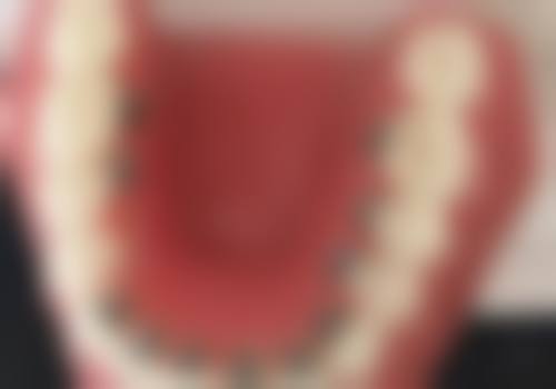 中卫至美口腔诊所患者口碑